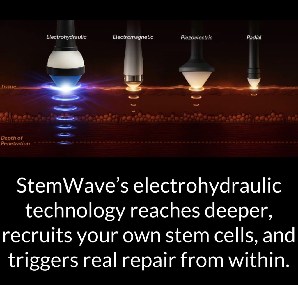 Educational StemWave graphic comparing electrohydraulic, electromagnetic, piezoelectric, and radial shockwave technologies, with text stating that StemWave’s electrohydraulic technology reaches deeper and supports stem cell recruitment and tissue repair.
